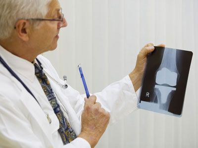 Doctor Reviewing X-Ray