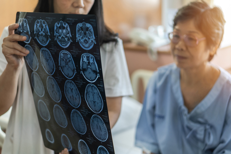 Traumatic Brain Injury Symptoms