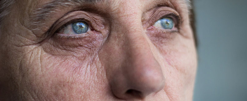 Can You See Me Now? Alzheimer’s and Eye Problems